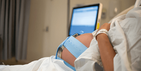 Monitoreo FetalDoppler Fetal